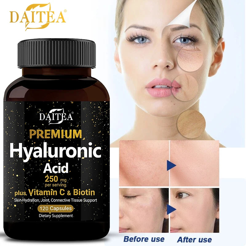 Hyaluronic Acid  Supplement | Contains Vitamin C and Biotin, Skin Moisturizing, Maintain Joint Health, Promote Hair Growth