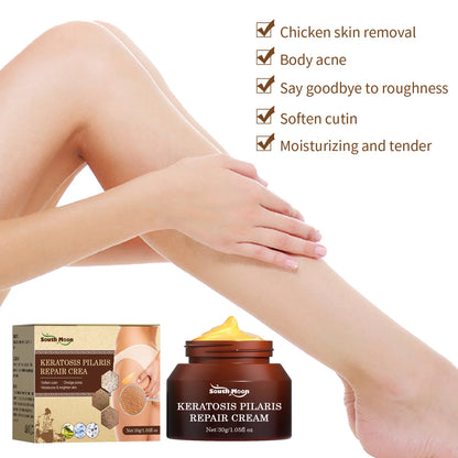 Keratosis Pilaris Removal Cream Chicken Skin Folliculities Treatment Repair Whitening Moisturizing Smooth Mild Body Lotion 30G